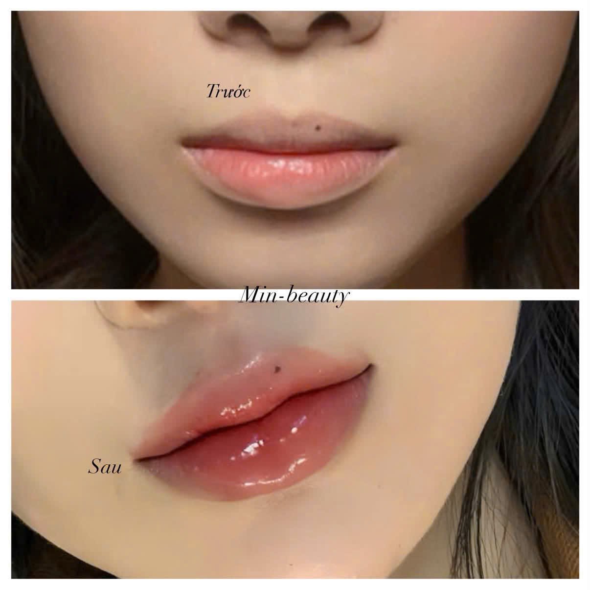 Kết quả Môi baby